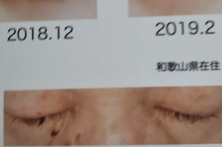 まつ毛美容液継続してみてください。